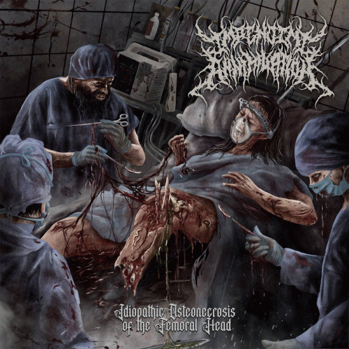 Impending Annihilation : Idiopathic Osteonecrosis of the Femoral Head